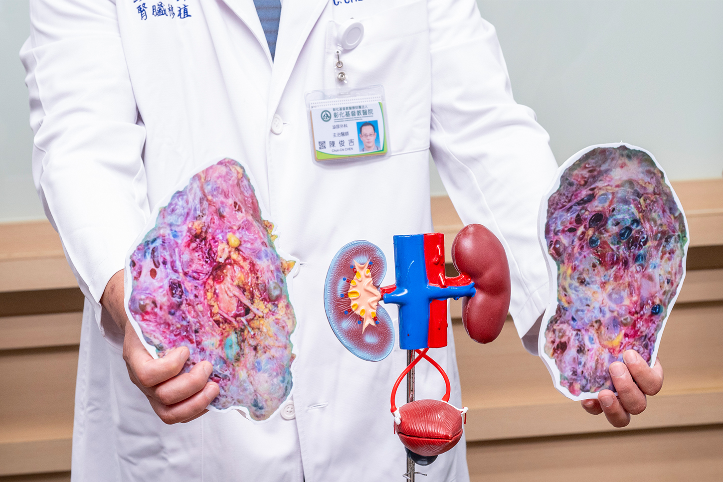 (有影片)/彰基完成活體腎臟移植 陳姓補教老師重獲新生重返講台 - https://www.watchmedia01.com