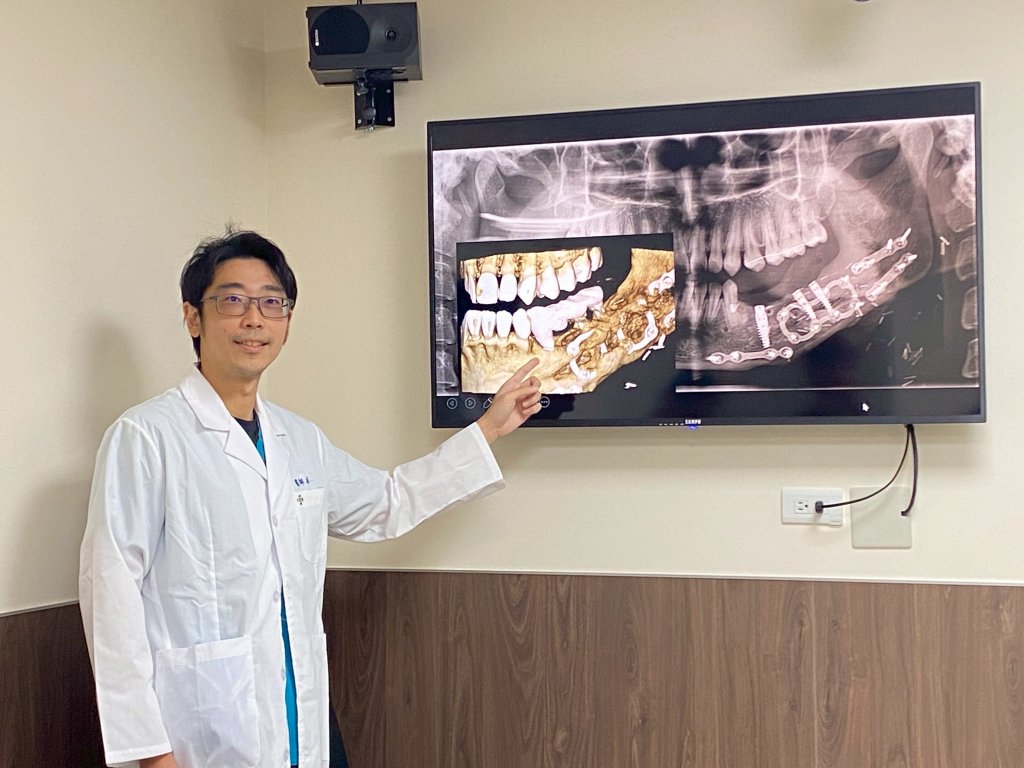 18歲少女罹患罕見顎骨腫瘤-3d列印重建手術重拾笑容