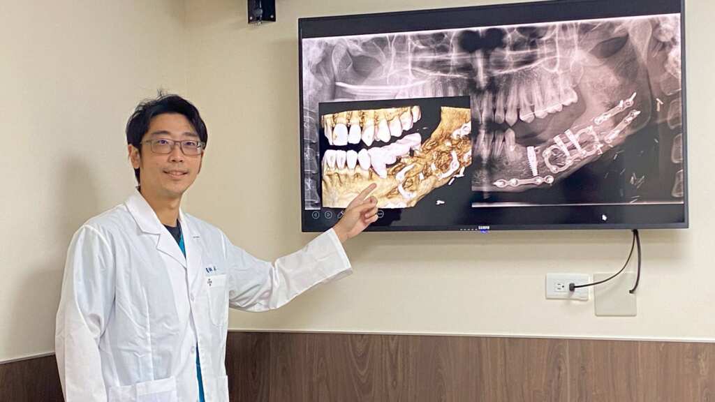 ▲林楠瑾醫師說明植牙設計是利用傾斜式植體All on 的概念完成。(圖/彰化秀傳紀念醫院提供)