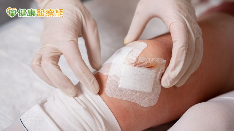 傷口照護學問多 醫師解析8種常見急、慢性傷口照護重點