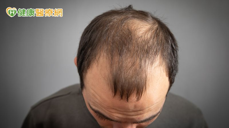 禿頭族新福音?台大研發「含天然脂肪酸」生髮精華 20天促小鼠毛髮再生