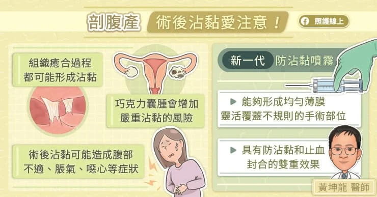 剖腹產注意術後沾黏