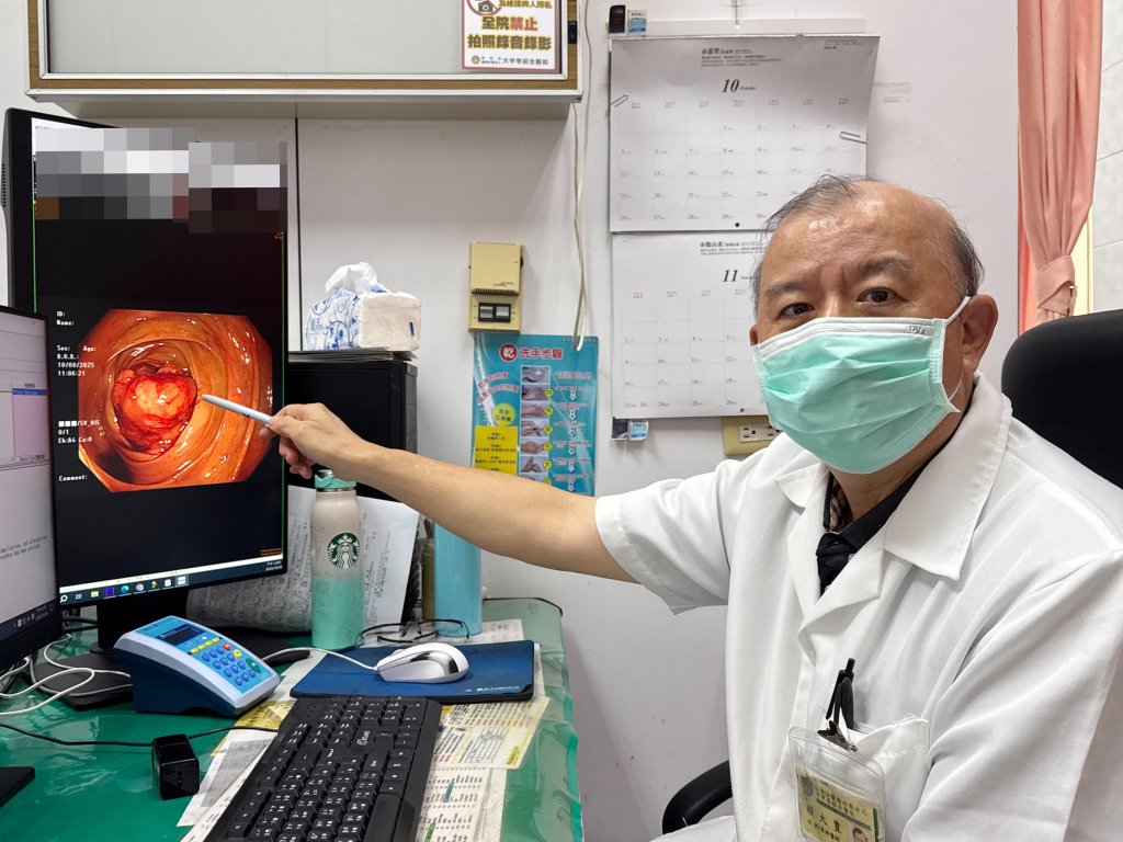 便祕一整天還血便-婦頭暈送醫檢查出大腸癌