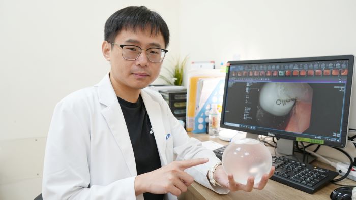 陪孩子玩你追我跑不喘了 胃內水球撐起減重希望 46 《圖說》張琮承醫師說明特殊水球放置時呈現扁狀,從口腔放入胃部後注入生理食鹽水才成為水球狀,置放時間約30分鐘。〈臺北醫院提供〉