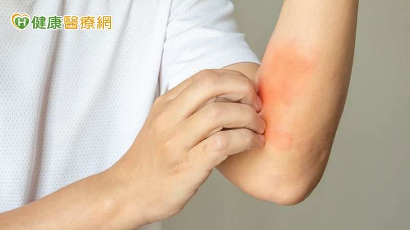抗生素引發史帝文強生症候群 研究:患自體免疫疾病風險增5.6倍
