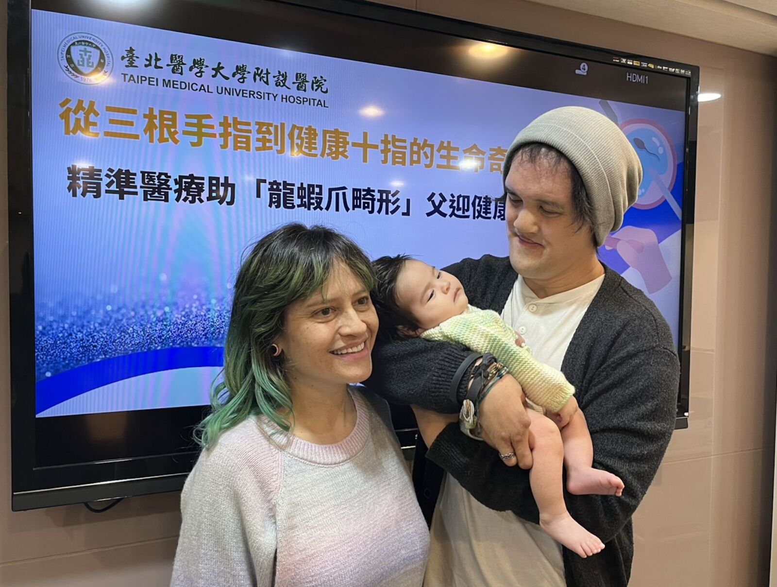 台灣醫療奇蹟 終結罕病遺傳！助「龍蝦爪畸形」父抱回健康女兒 225