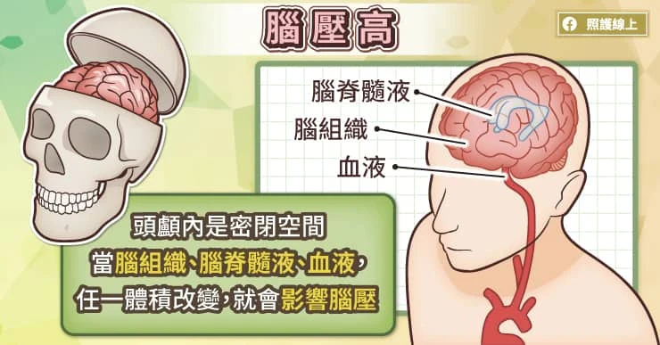 腦壓高是什麼?