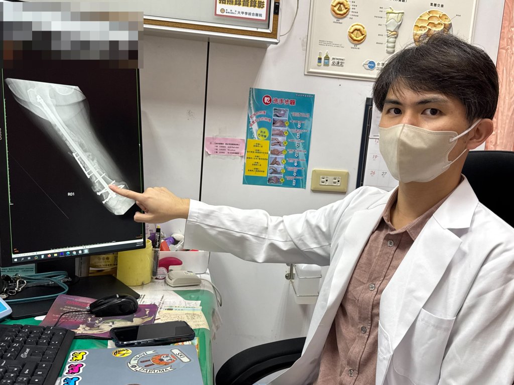 8旬翁大腿斷三截-三次術後喊「我要再參加媽祖遶境」