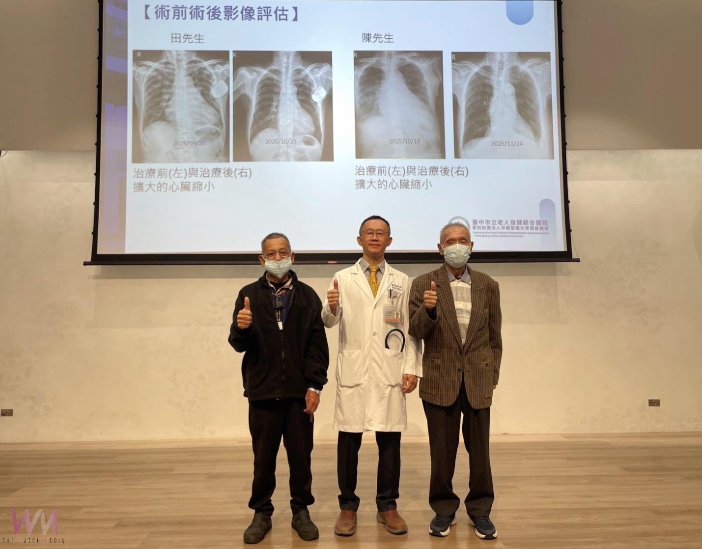 腳水腫易喘竟是心臟瓣膜問題 中醫大市醫:修補僧帽瓣手術 開心找回呼吸 - https://www.watchmedia01.com