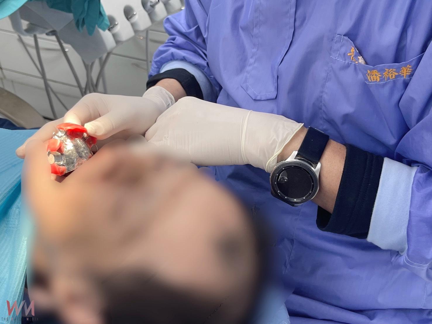 僅能張口2公分!中山附醫導入「數位口掃」技術 口腔癌患者重建功能展笑容 - https://www.watchmedia01.com