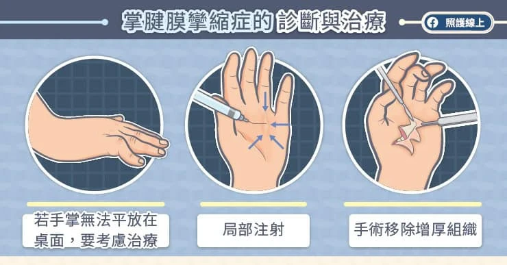 掌腱膜攣縮症的診斷與治療
