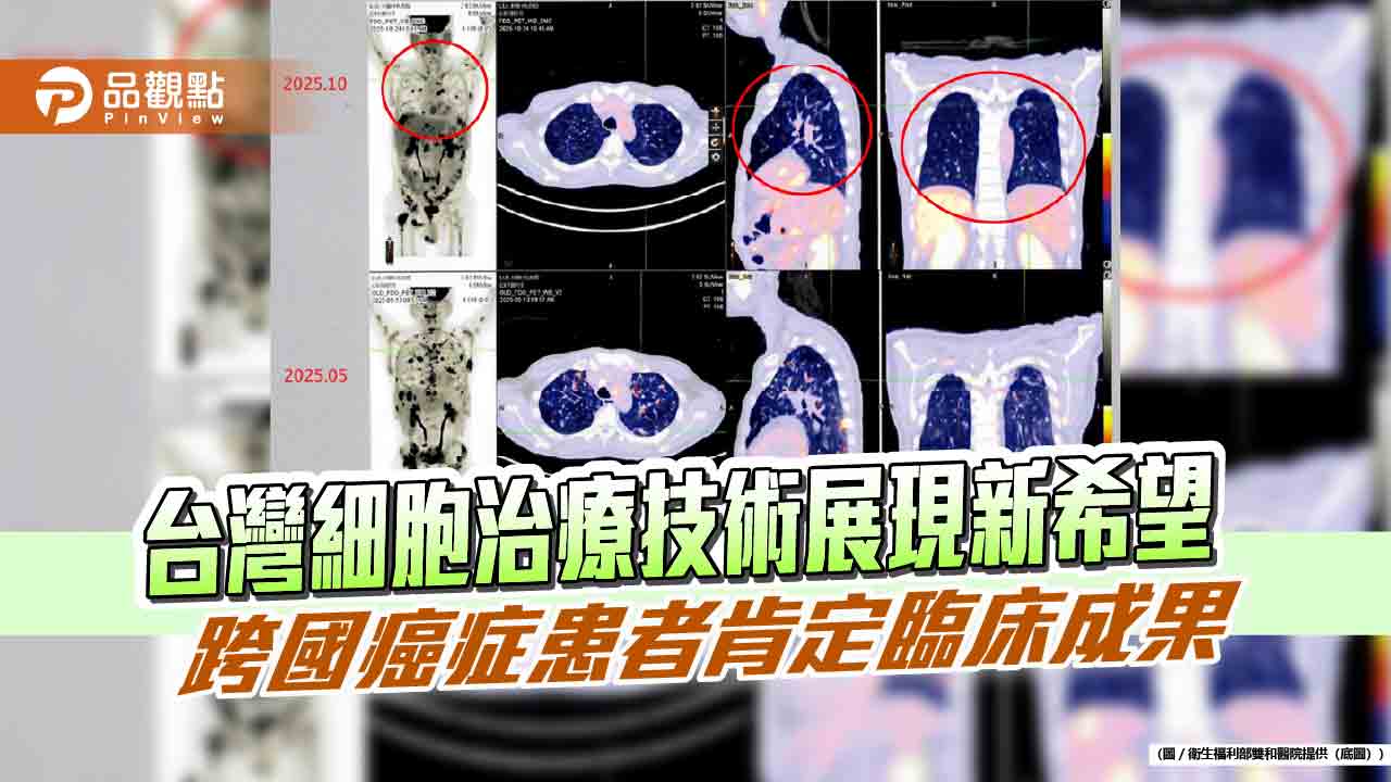 台灣細胞治療技術展現新希望　跨國癌症患者肯定臨床成果