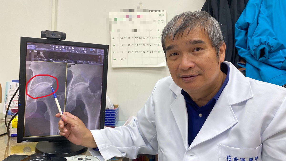 裝潢師傅蹲了一輩子卻再也蹲不下去 醫師診斷為髖關節夾擠症候群