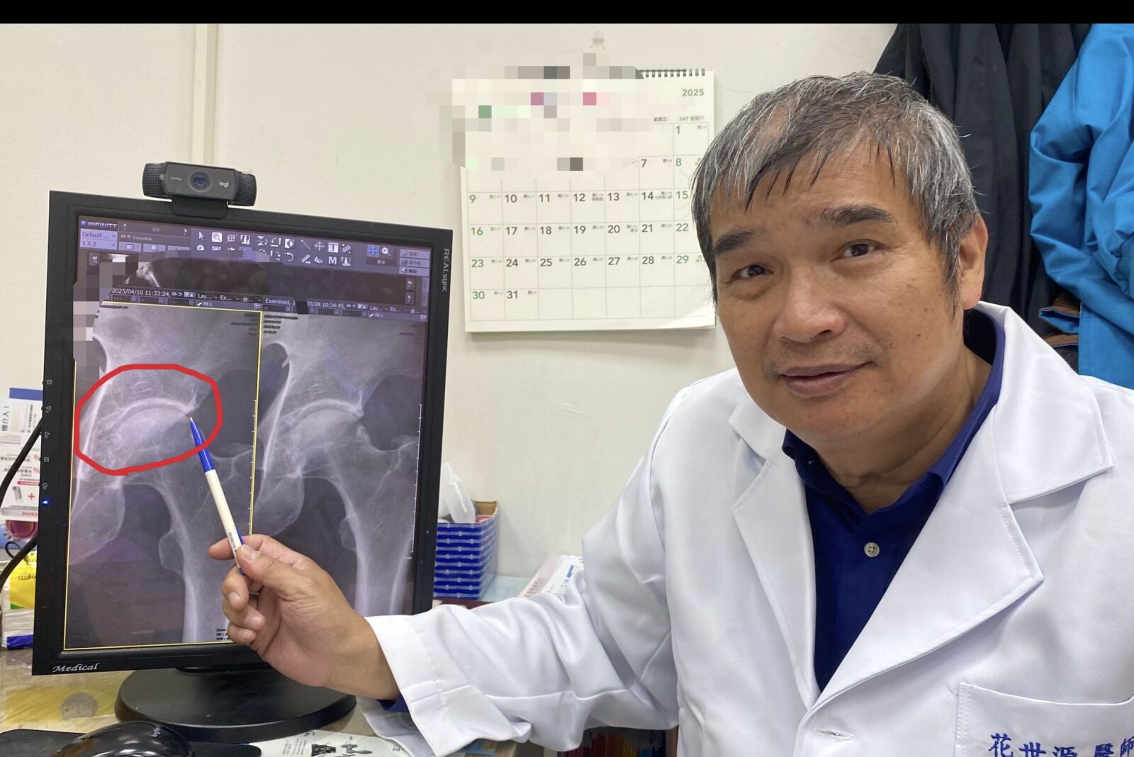 走路沒事「一蹲就痛」? 長時間深蹲小心髖關節夾擊症候群 224 走路沒事「一蹲就痛」? 長時間深蹲小心髖關節夾擊症候群 223