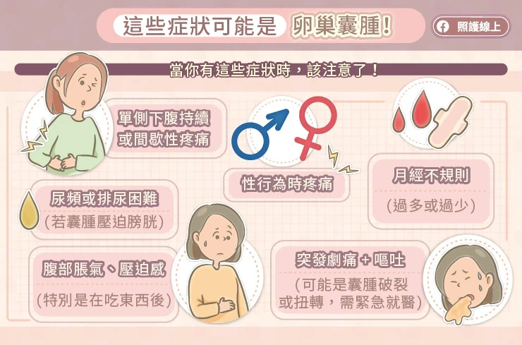 卵巢囊腫的症狀