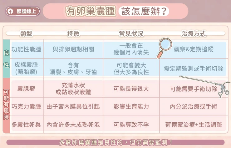 卵巢囊腫的治療