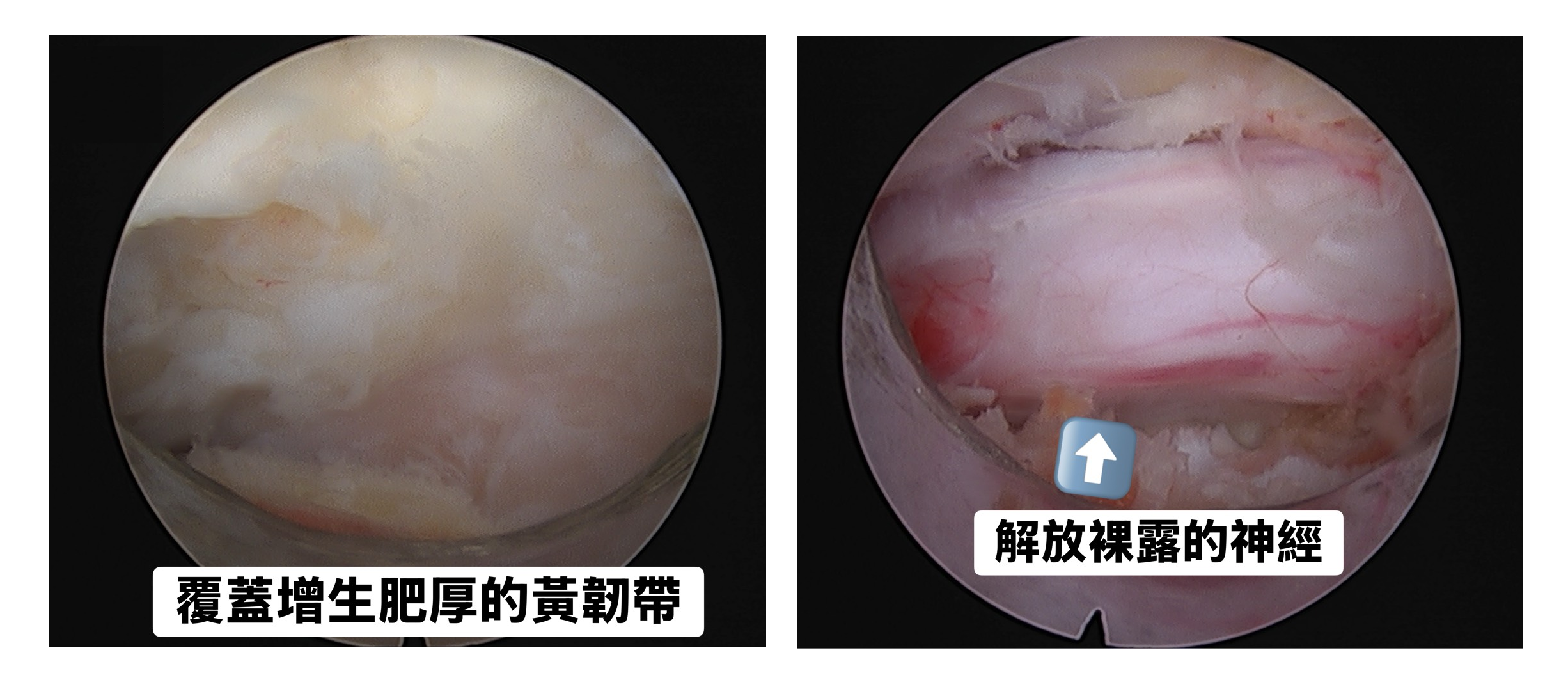 內視鏡手術過程 0