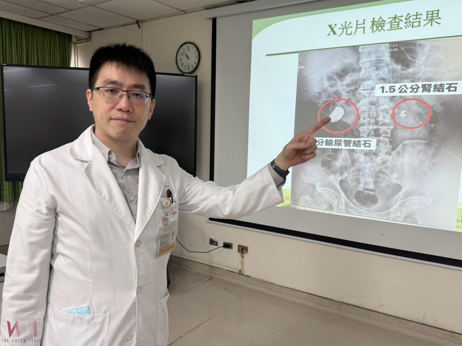 驚!男腰痠血尿就醫 右輸尿與左腎赫見大結石 緊急取石手術、震波碎石治療 - https://www.watchmedia01.com