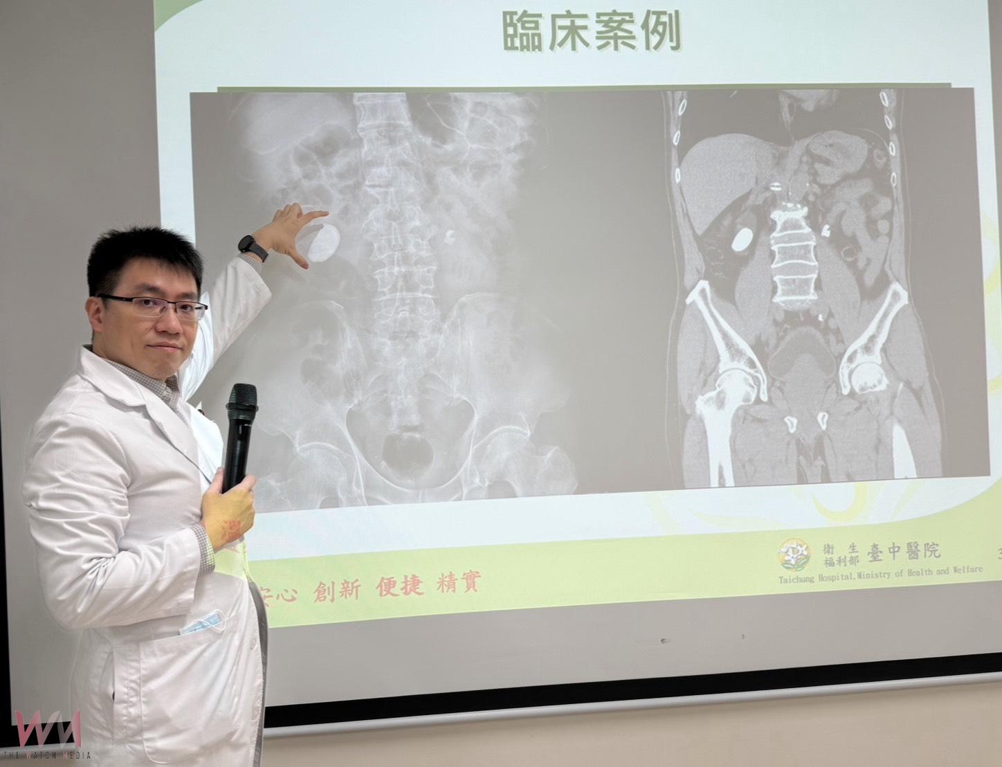 驚!男腰痠血尿就醫 右輸尿與左腎赫見大結石 緊急取石手術、震波碎石治療 - https://www.watchmedia01.com