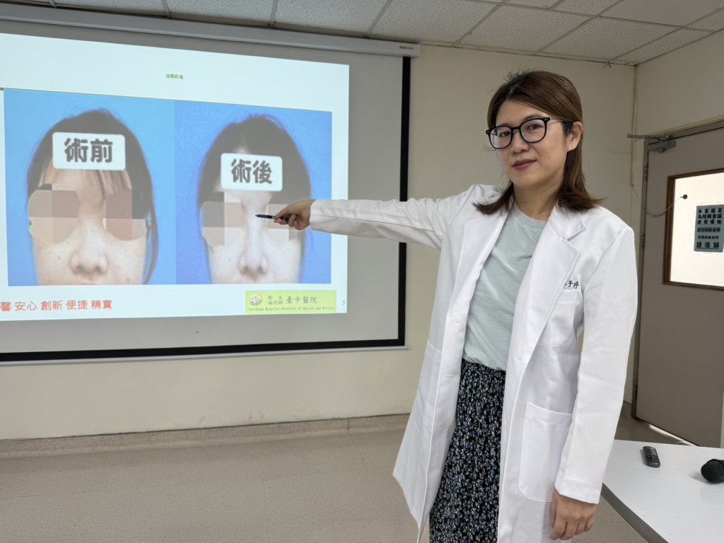 蘋果姐姐遇車禍撞歪鼻子-這手術讓她重建堅挺鼻樑大口呼吸
