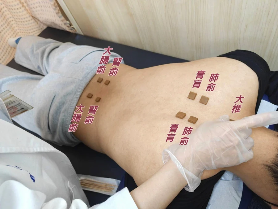 三九敷貼方法與後續照護