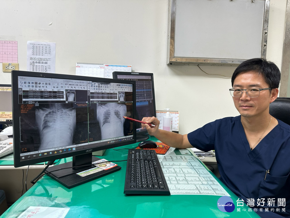 心臟血管外科胡家瑜醫師啟動 ECMO（葉克膜）治療，暫時取代心肺功能，使氧合與血流狀況得以穩定，成功撐過最危險階段。