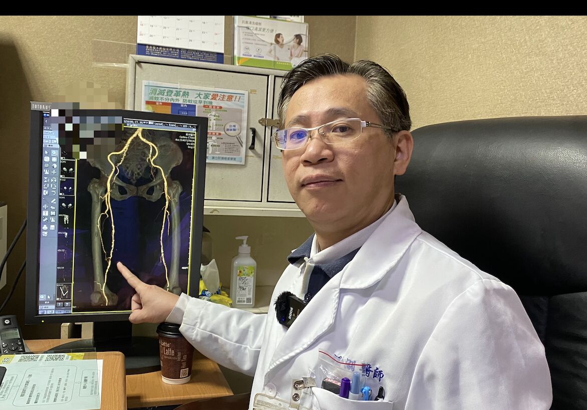 車禍小腿破皮竟惡化「爛到幾乎見骨」 傷口不癒元凶藏在血管 216 車禍小腿破皮竟惡化「爛到幾乎見骨」 傷口不癒元凶藏在血管 215