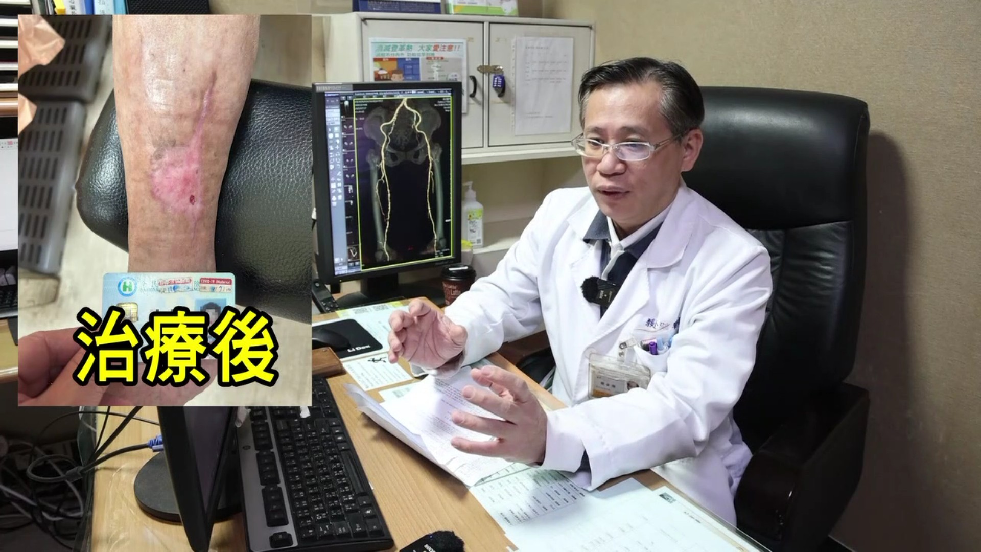 （有影片）／慢性傷口久未癒合　心臟外科主任揪出「血液循環雙重障礙」 - https://www.watchmedia01.com