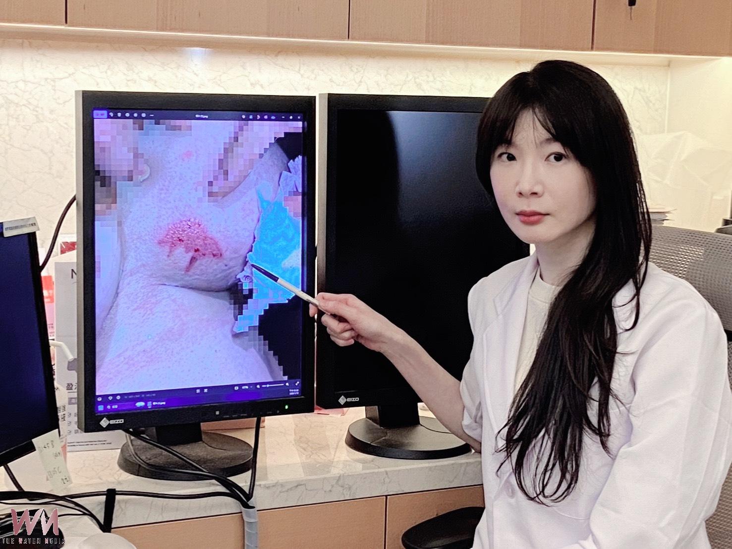中年婦女抗寒搞創意  暖暖包放乳溝搞成淺二級燙傷