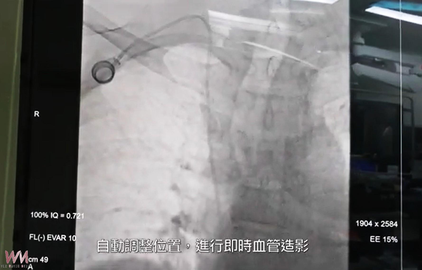 （有影片）／臺大雲林高階複合手術室上線　在地人享醫學中心級手術品質 - https://www.watchmedia01.com