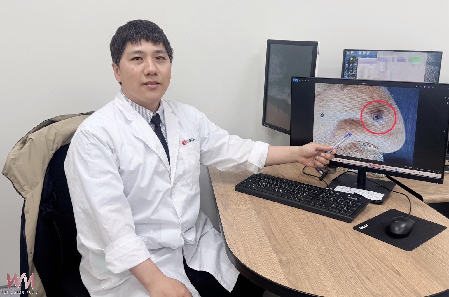 7旬翁鼻上黑點以為是痣拖兩年 明顯變化又出血確認「基底細胞癌」 - https://www.watchmedia01.com