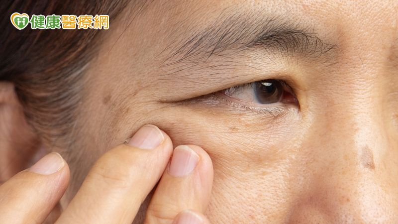 眼皮狂跳10年「睜不開眼」！婦人差點出車禍　醫揭罕見病因