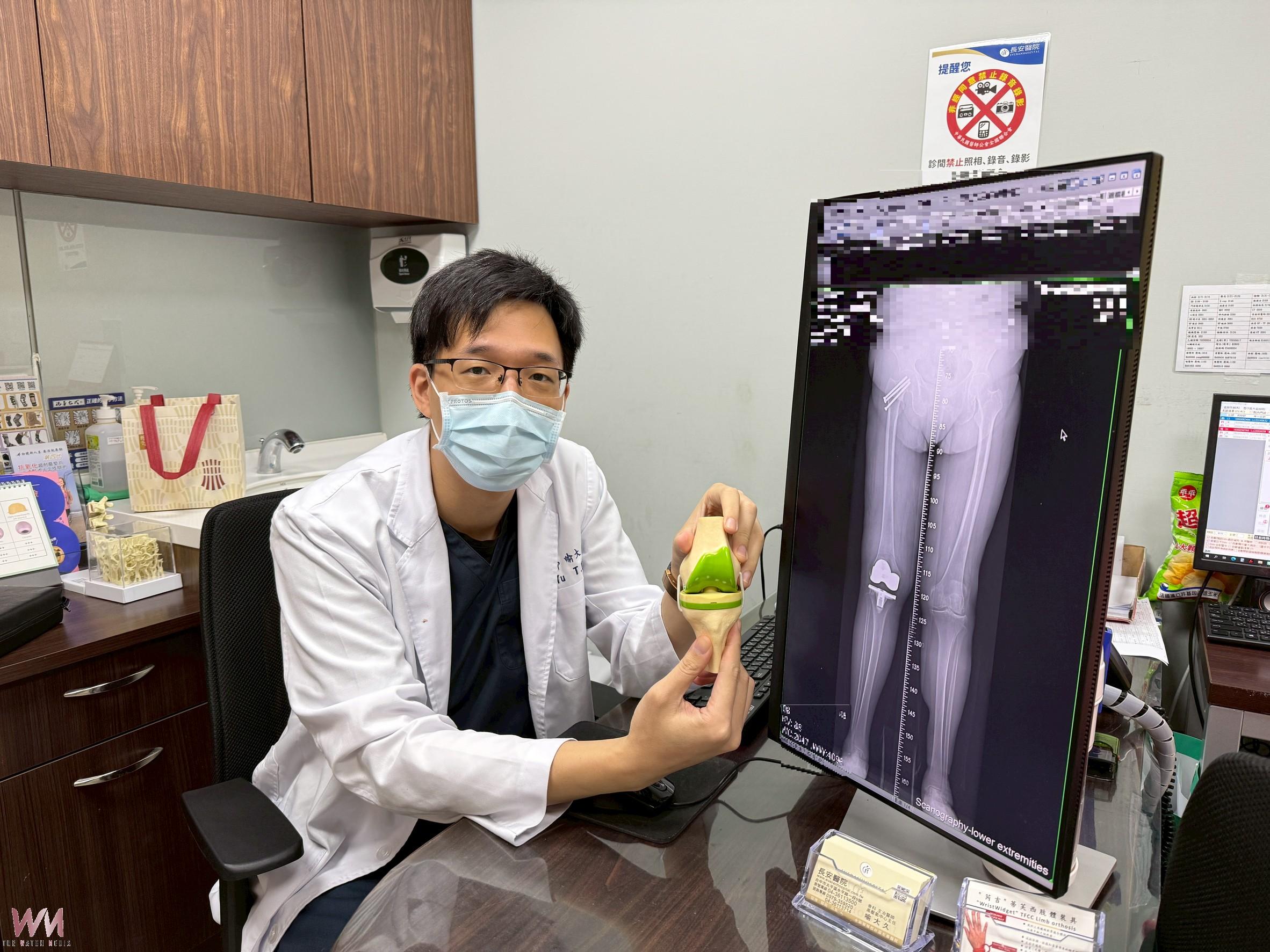 8旬嬤X型腿走路互撞慘跌骨折 人工膝關節置換重拾穩健步伐 - https://www.watchmedia01.com