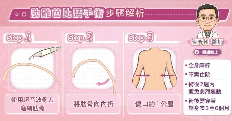「肋雕芭比腰手術」調整腰部曲線
