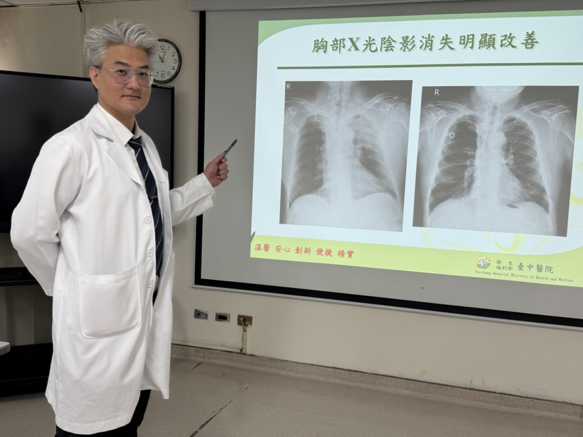 衛生福利部臺中醫院腫瘤內科江佳駿醫師說明，患者到院時左胸有14公分惡性腫瘤（左圖），經過初步標靶合併化療，腫瘤大為縮小，有明顯改善（右圖）。圖/台中醫院提供