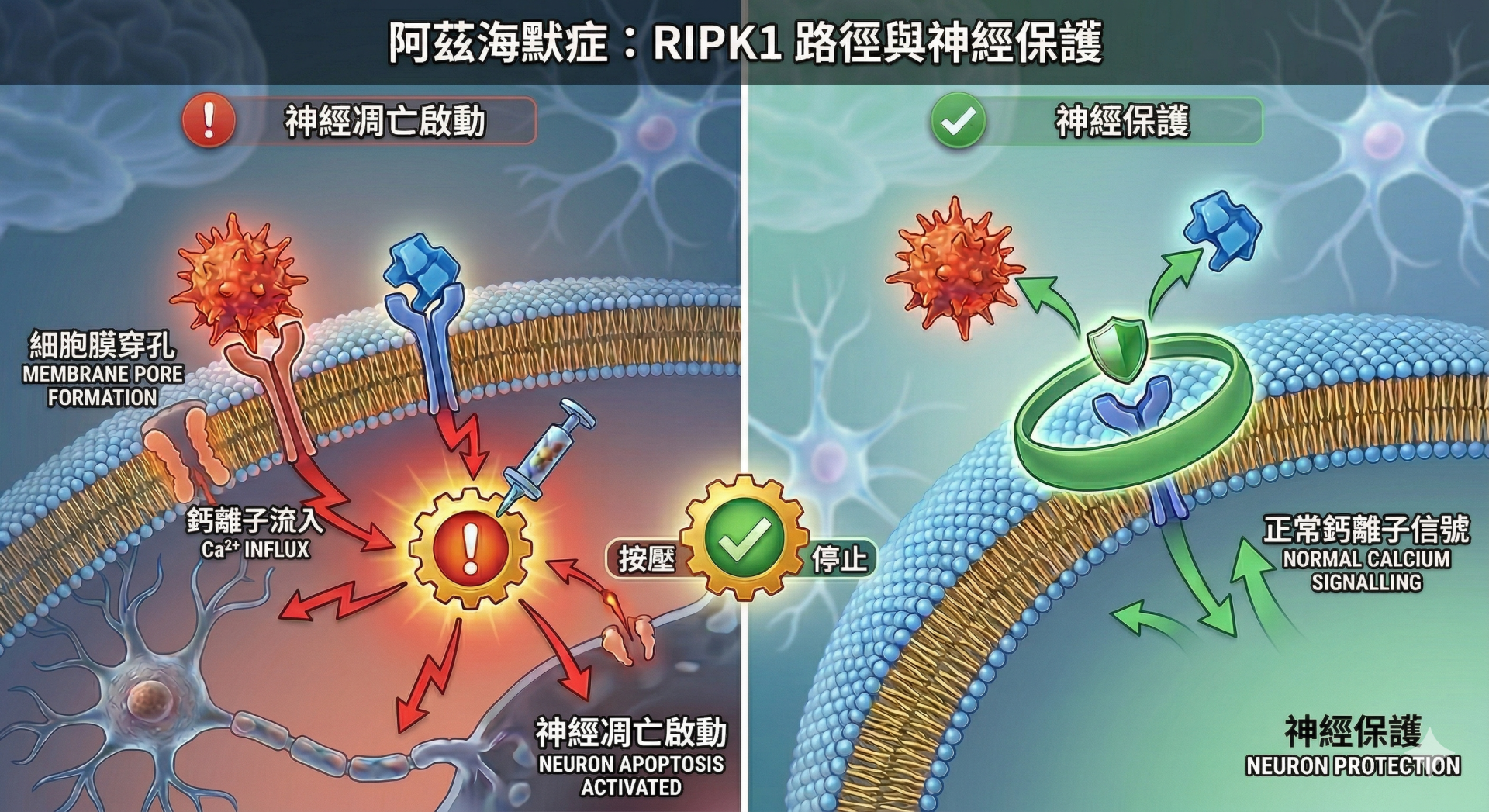 【示意圖:阿茲海默症「RIPK1」路徑與神經保護】左側(問題): 展示了 TNFR1-RIPK1 結合如何異常激活「死亡開關」,導致細胞膜穿孔、鈣離子流入,最終引發神經元凋亡。右側(解決方案): 展示了「小分子抑制劑」如何精準地卡在毒性蛋白質之間,防止其結合,從而實現「神經保護」。
