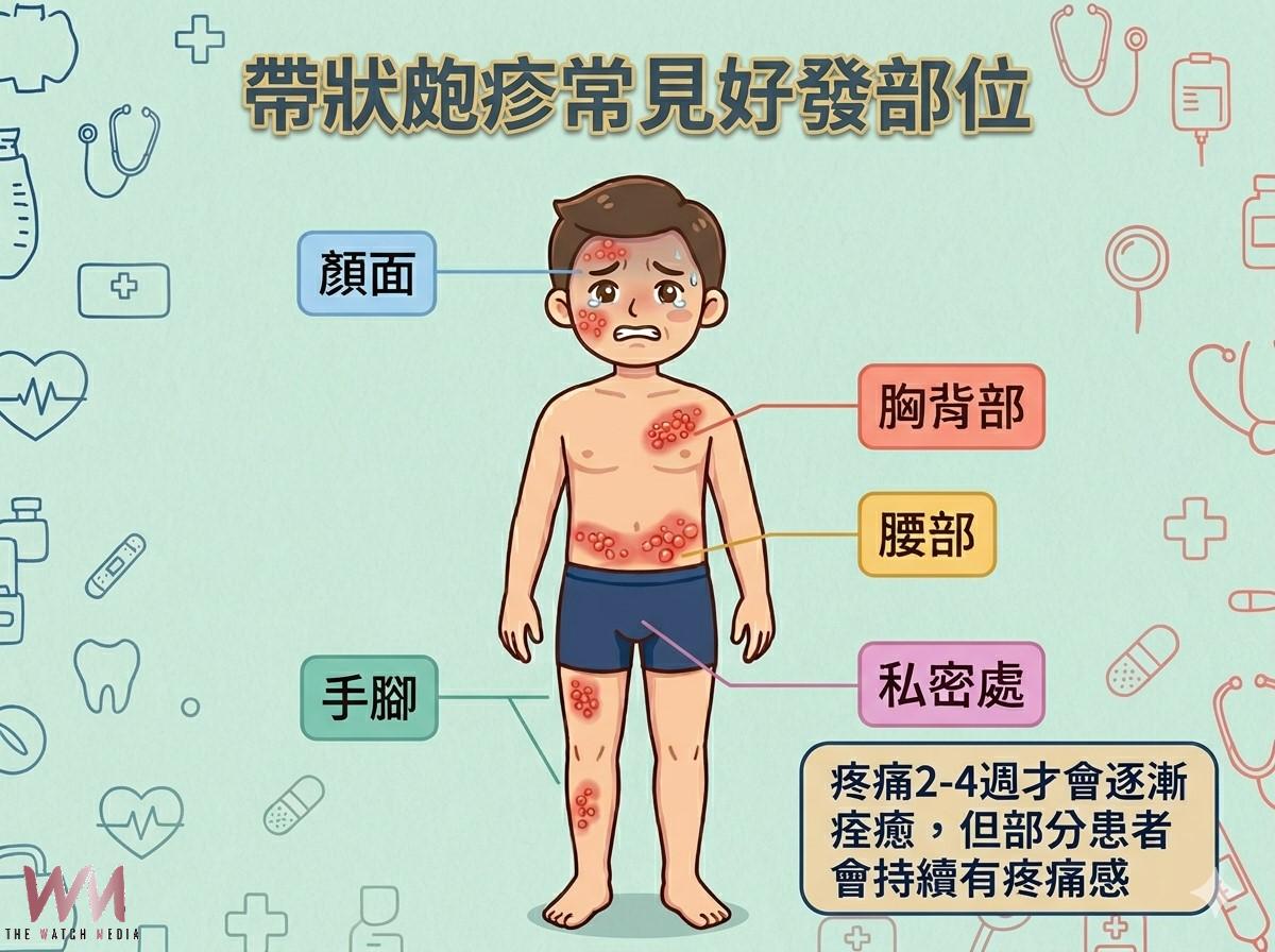 皮蛇痛起來要人命 接種疫苗有效改善發病後的疼痛感 - https://www.watchmedia01.com