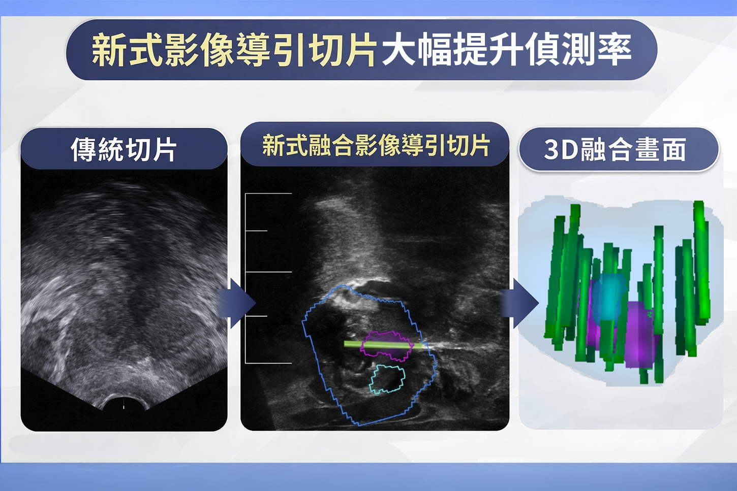 （有影片）／PSA異常揪攝護腺癌　兩農民靠精準醫療治療成功 - https://www.watchmedia01.com
