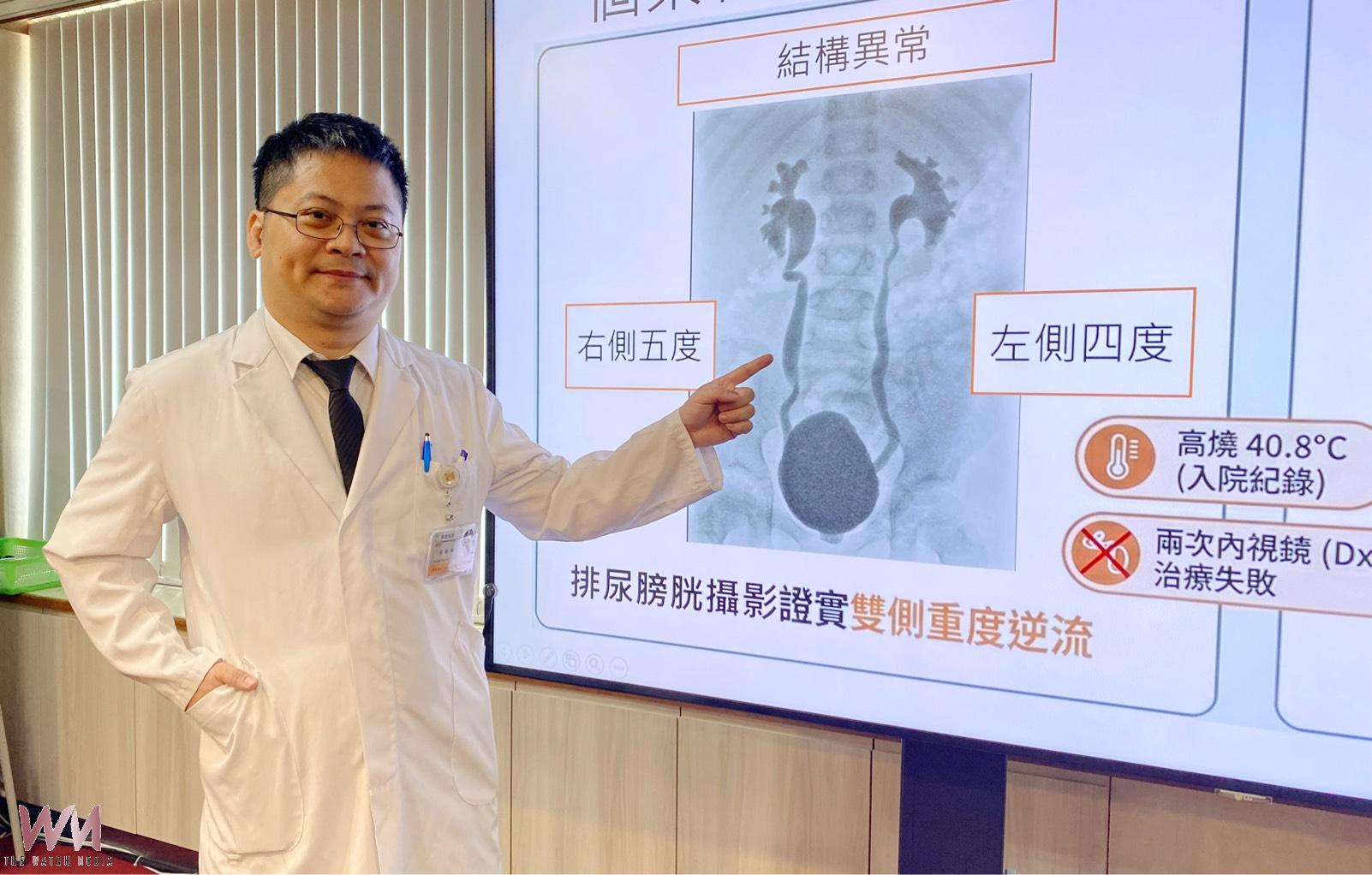 單孔達文西助攻 台中榮總成功治療女童先天嚴重膀胱輸尿管逆流 - https://www.watchmedia01.com