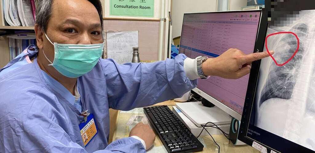 ▲員榮醫療體系員榮醫院急診室王胤德醫師表示,患者因感冒引發「肺膿瘍合併肺炎」。 (圖/員榮醫院提供)