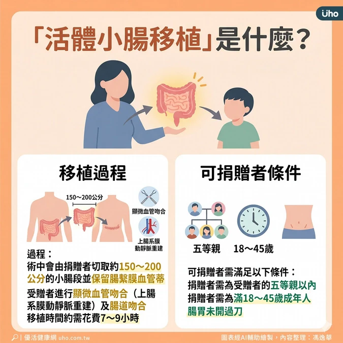 亞東率先完成活體小腸移植