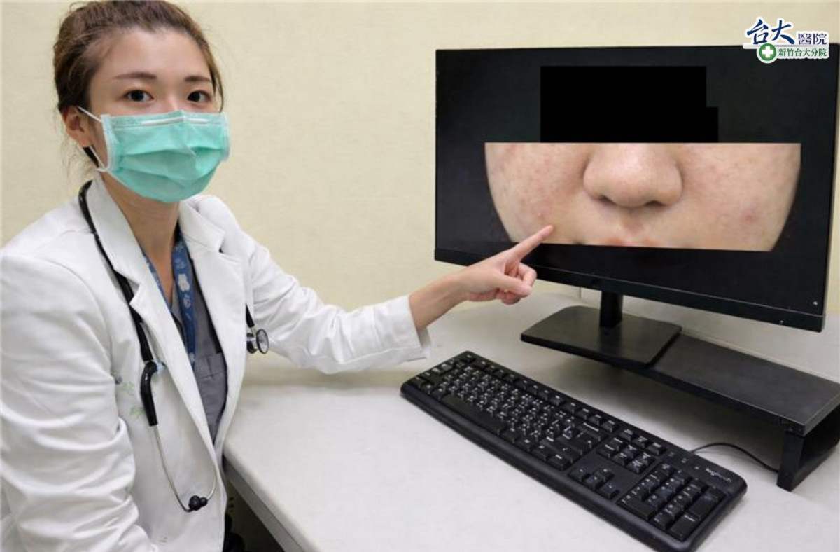 急診醫師石庭慧說明，臉部、嘴唇或眼皮腫脹可能是過敏性休克。