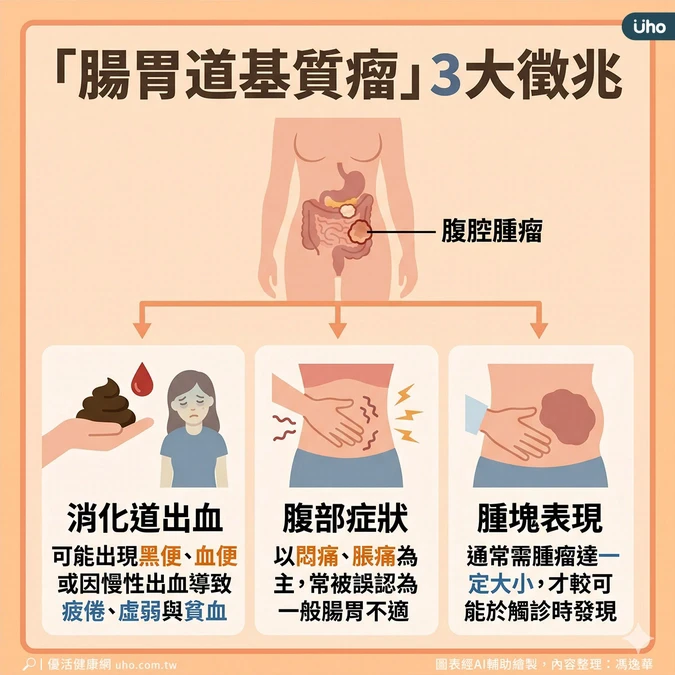 腸胃道基質瘤3大徵兆