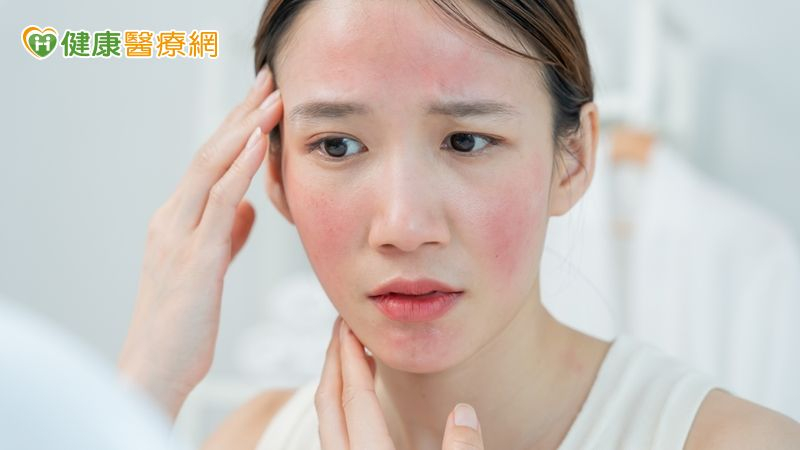 妝容不服貼還伴隨刺癢灼熱 當心是酒糟膚質在作祟