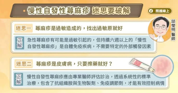 慢性自發性蕁麻疹擦藥就好嗎?