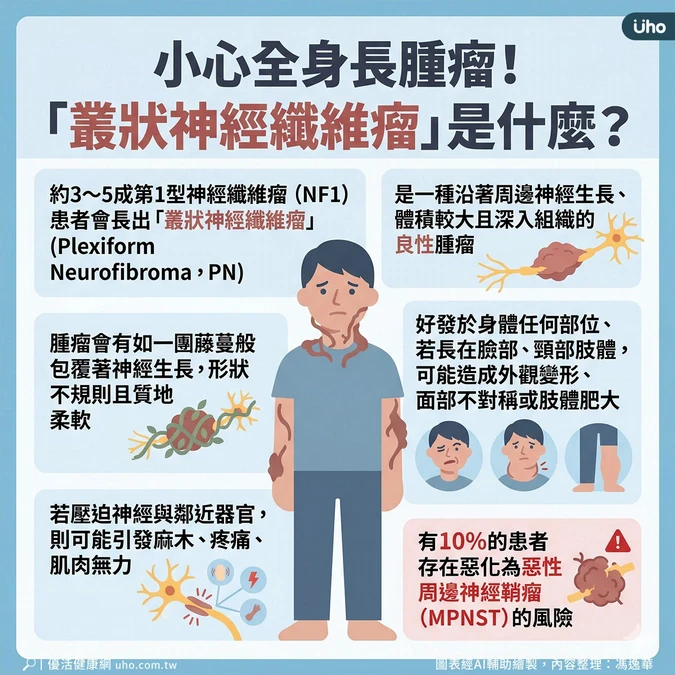 逾3成患者有叢狀神經纖維瘤