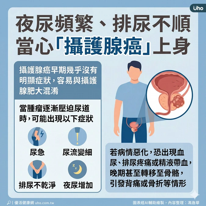 攝護腺癌早期無明顯症狀