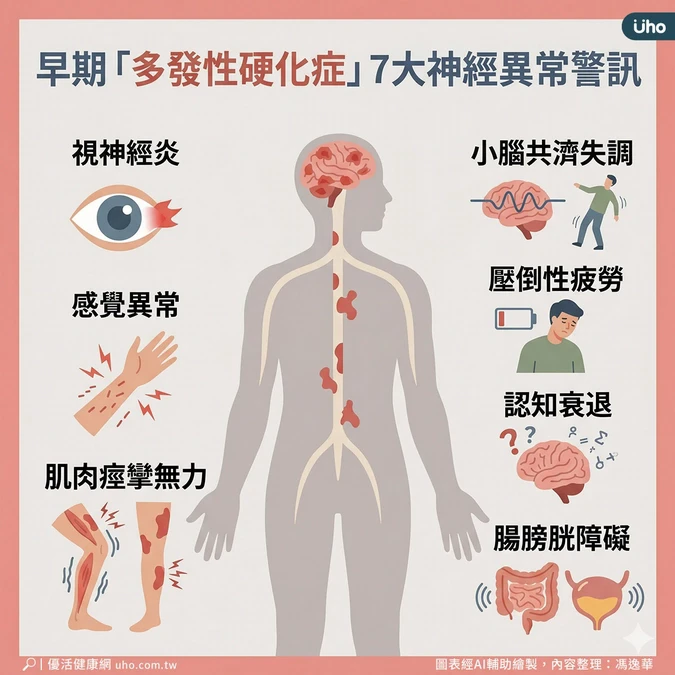 早期7大神經受損警訊