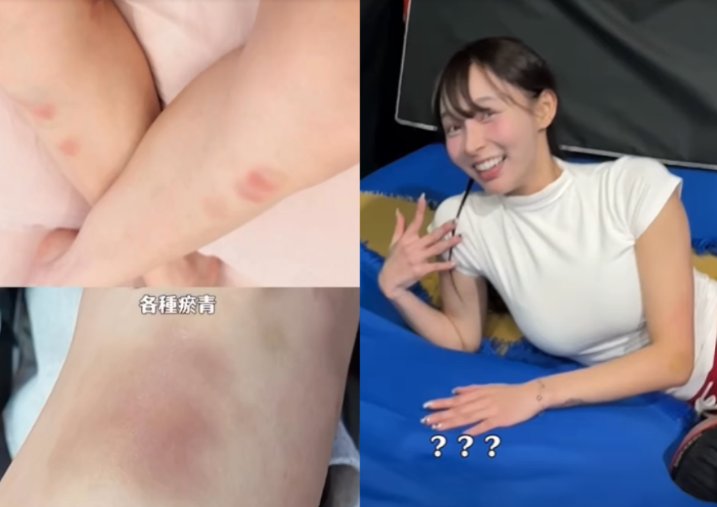 林襄挑戰競技啦啦隊，練到雙腿瘀青。（圖／翻攝林襄臉書）