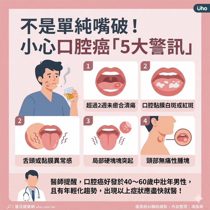 口腔癌5大警訊